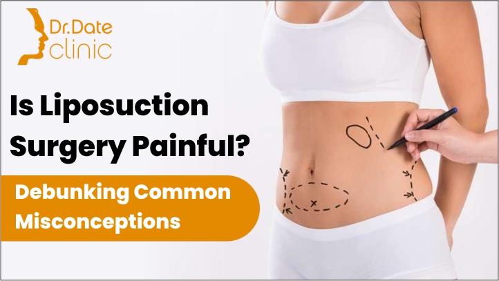 Is Liposuction Surgery Painful? Debunking Common Misconceptions