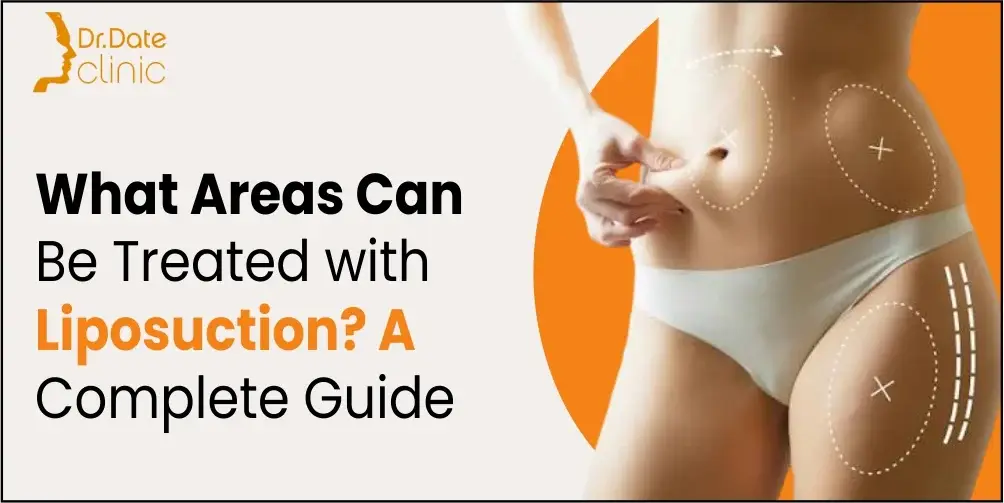 What areas can be treated using Liposuction? A Complete Guide