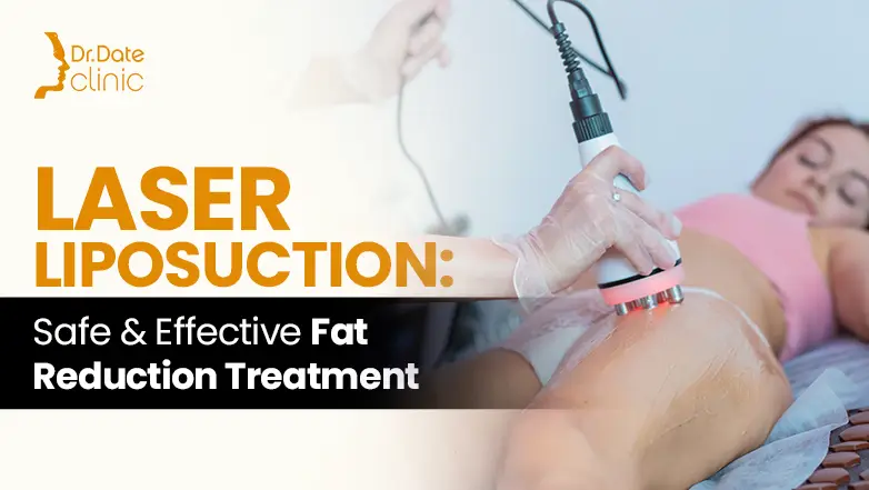 Laser Liposuction: Safe & Effective Fat Reduction Treatment