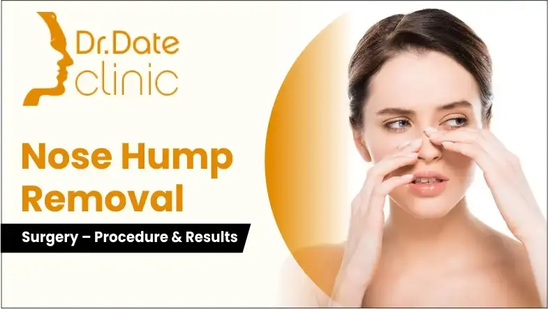 Everything You Need to Know About Nose Hump Removal Surgery