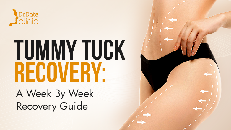 Tummy Tuck Recovery: A Week By Week Recovery Guide