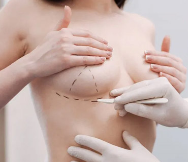Breast Surgery